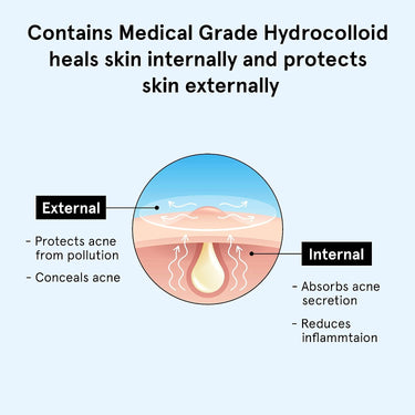 Be Bodywise Snail 96 Mucin Serum 100ml & Hydrocolloid Acne Patch (24 Dots | 3 Sizes) | Absorbs & Flattens Acne Overnight,Soothes, Hydrates & Moisturises Skin | 0.5% Niacinamide, 96% Snail Mucin